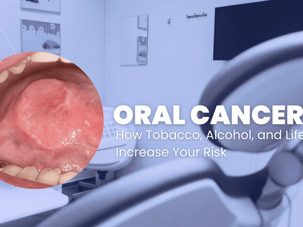 Oral-cancer-cure_1