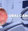 Oral-cancer-cure_1